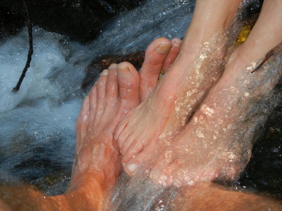 Myose des ongles des jambes